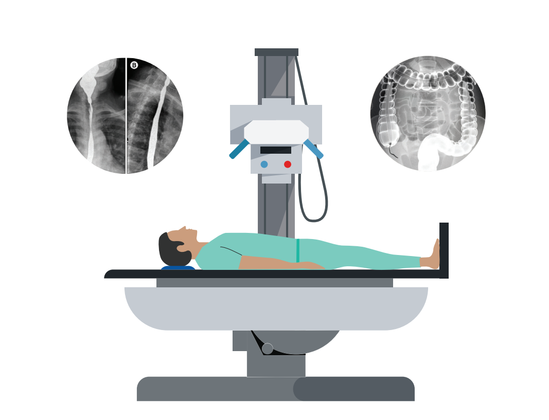 Your Barium X-ray Journey