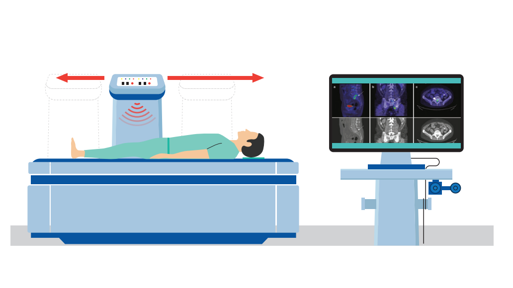 Your Bone Scan Journey