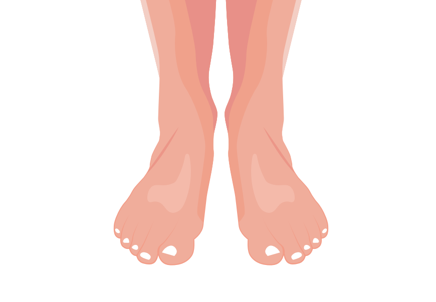 Taking Care of Your Feet: A Guide for People with Diabetes
