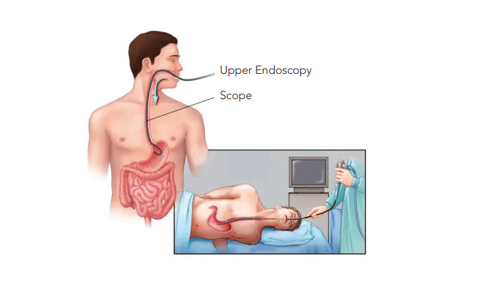 Your Endoscopy Experience