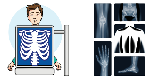 Your X-ray Experience